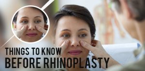 Things-To-Know-Before-Rhinoplasty